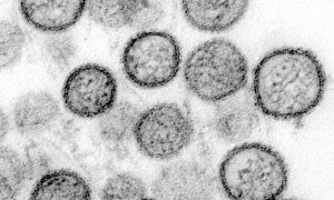 10 Most Dangerous Viruses that Wreaked Havoc Before Corona Virus