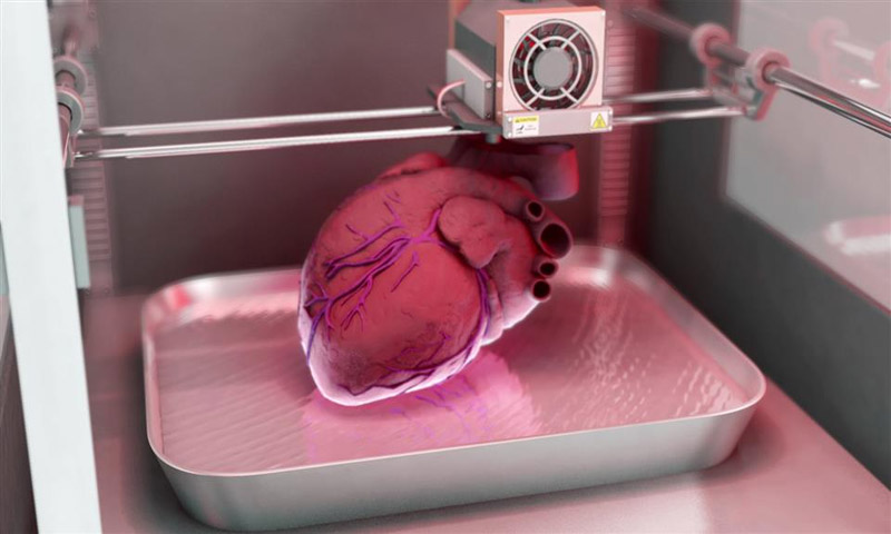 Are 3-D Printers Our New Organ Donors?