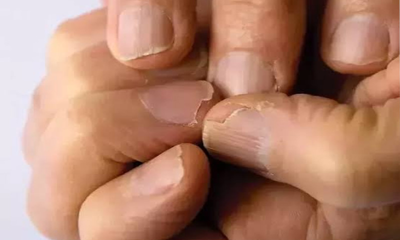 What do Your Nails Say About Your Health